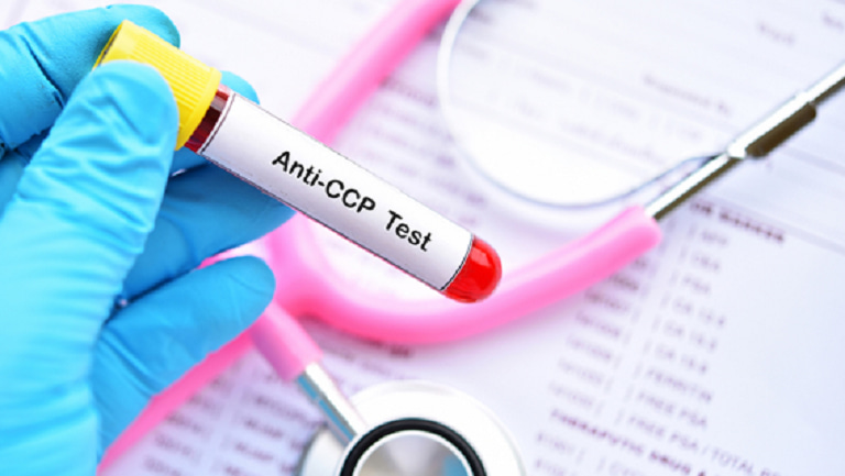 Xét nghiệm yếu tố Anti CCP là loại xét nghiệm đặc hiệu giúp chẩn đoán viêm khớp dạng thấp