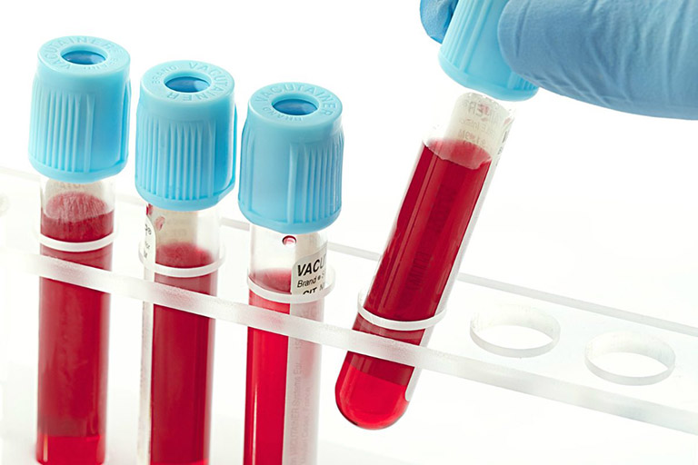 Xét nghiệm máu cũng có thể được dùng để chẩn đoán bệnh