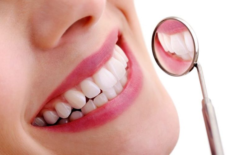 Bọc răng sứ nguyên hàm và một số thông tin bạn cần biết