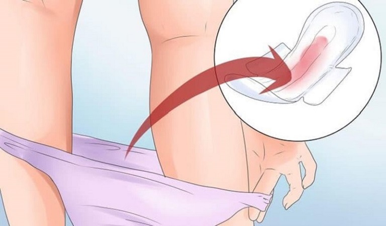 Đặt thuốc viêm cổ tử cung bị chảy máu có thể do nhiều nguyên nhân