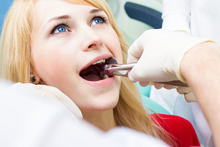 Giá niềng răng khấp khểnh tùy thuộc vào phương pháp thực hiện