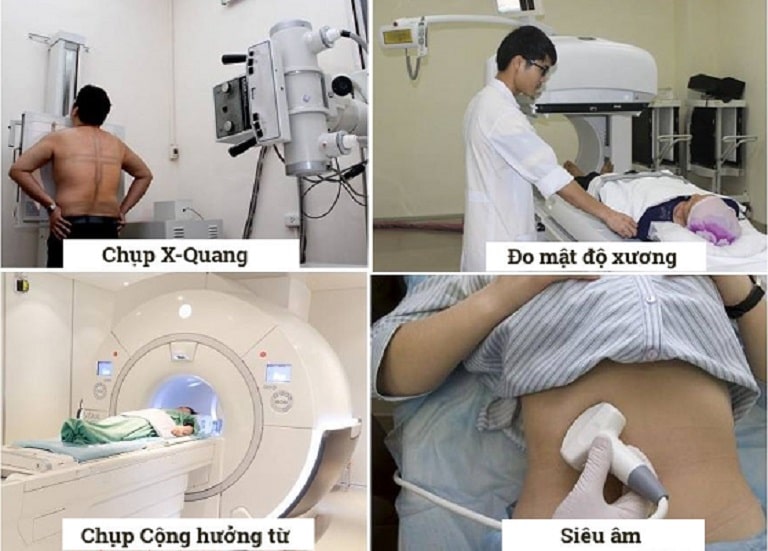 Một số kỹ thuật chẩn đoán bệnh cơ xương khớp tại Bệnh viện Bạch Mai