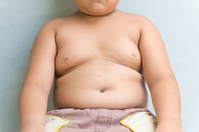 Trẻ thừa cân béo phì có nguy cơ cao mắc các bệnh lý về xương khớp