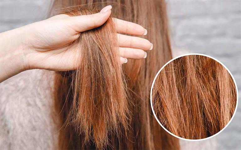 Tóc khô xơ rối là do những lớp biểu bì của tóc bị tổn thương