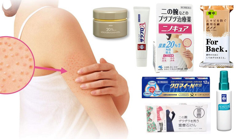 Các sản phẩm hỗ trợ, thuốc trị viêm nang lông của Nhật Bản được nhiều người tin dùng