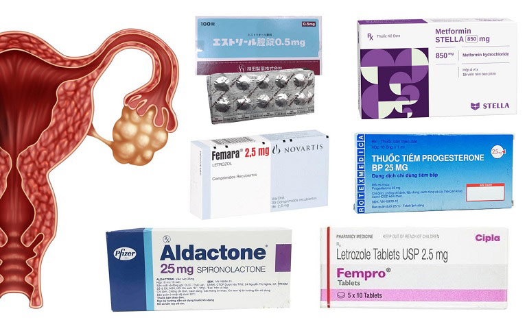 Có nhiều loại thuốc trị đa nang buồng trứng trên thị trường hiện nay
