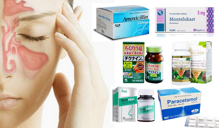 Trên thị trường có nhiều loại sản phẩm bổ trợ và thuốc trị viêm xoang tốt