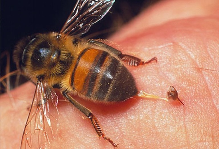 Ong vò vẽ cắn gây đau và nguy hiểm đến sức khỏe? Cùng tìm hiểu ngay 15 cách chữa ong vò vẽ cắn nhanh