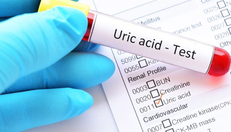 Acid uric bao nhiêu là cao? Nếu trên 4.0 ± 1mg/dl với nữ, trên 5.1 ± 1mg/dl với nam