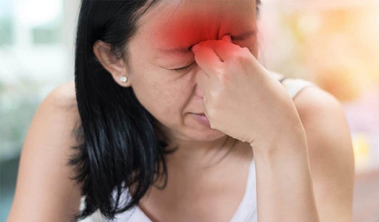 Viêm xoang gây triệu chứng đau đầu