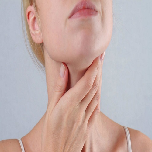 Viêm họng mãn tính là tình trạng viêm họng kéo dài và tái phát nhiều lần