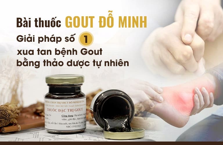 Bài thuốc Đỗ Minh - Top 1 chữa bệnh gout bằng Đông y