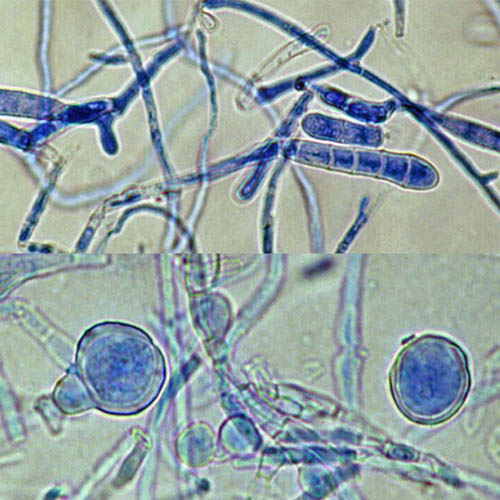 Bệnh xảy ra do chủng nấm nấm Dermatophytes