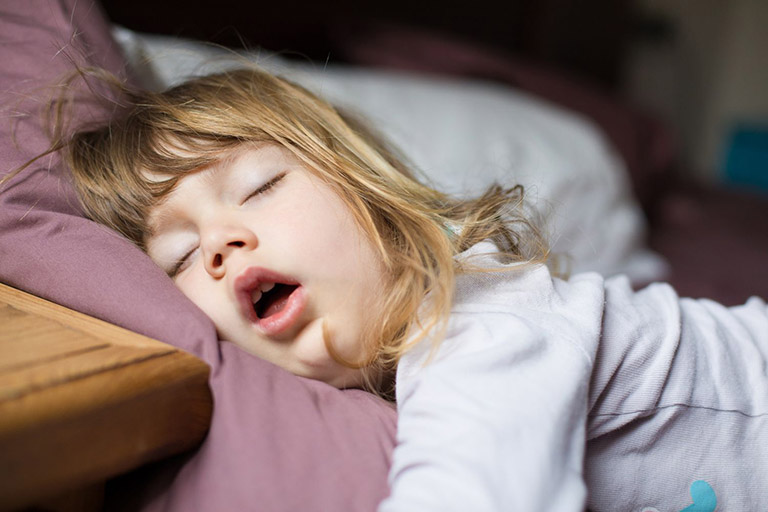 Viêm VA độ 3 khiến trẻ thường xuyên há miệng khi thở