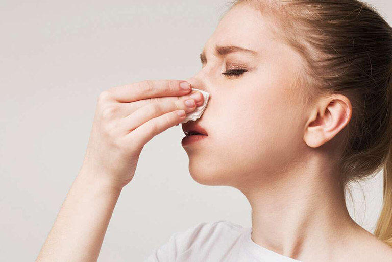 Sơ cứu chảy máu mũi đúng cách cho người viêm xoang