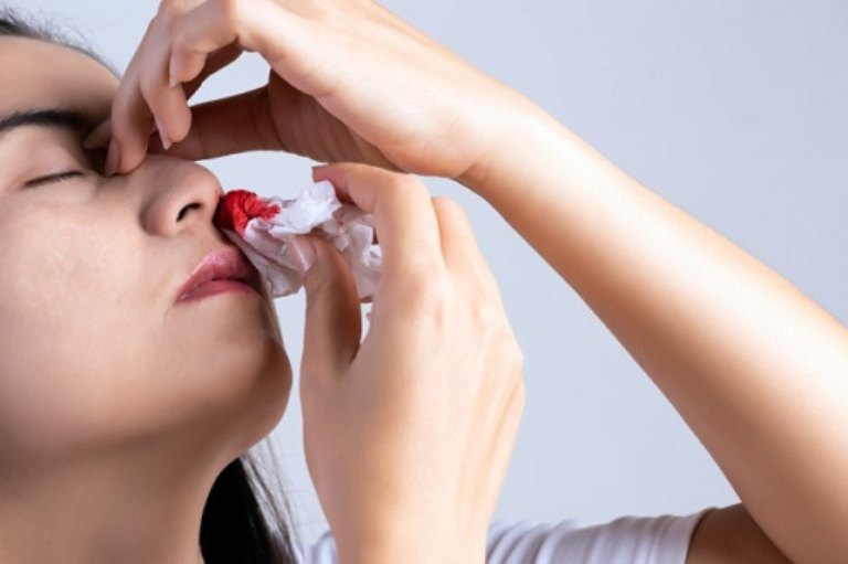 Người bị viêm mũi dị ứng có thể gặp phải tình trạng chảy máu mũi