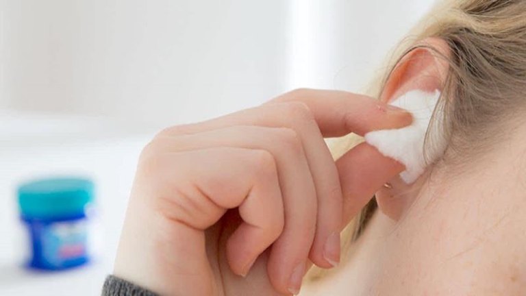 Vệ sinh tai khi bị viêm tai giữa cần được thực hiện đúng cách để đảm bảo an toàn cho tai