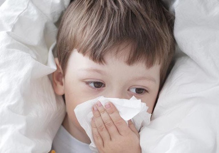 Polyp mũi ở trẻ em có thể ảnh hưởng nhiều đến chất lượng cuộc sống của trẻ