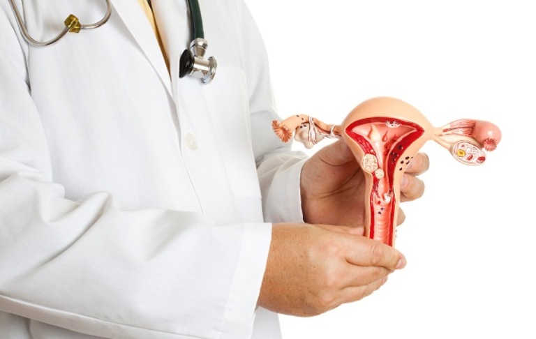 Nhân xơ tử cung có liên quan mật thiết đến sự gia tăng nội tiết tố estrogen 